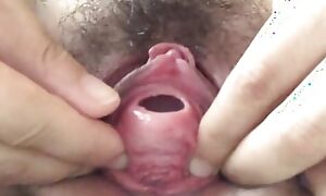 Anal stick insertion into the urethra